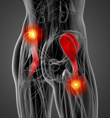 iliacus tıbbi çizimi