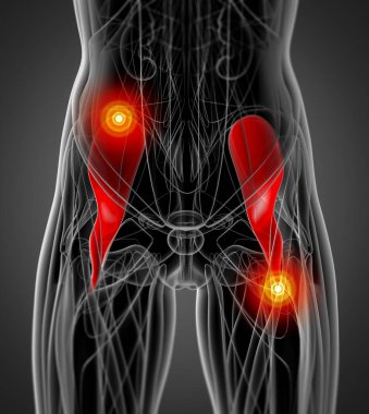 iliacus tıbbi çizimi