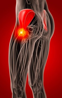 gluteus medius tıbbi çizimi