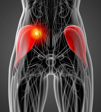 gluteus medius tıbbi çizimi