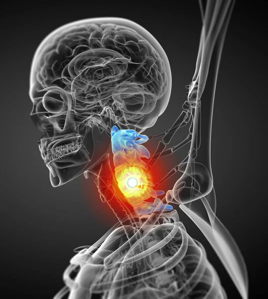 Показать Медицинскую Иллюстрацию Шейного Отдела Позвоночника Вид Сбоку — стоковое фото