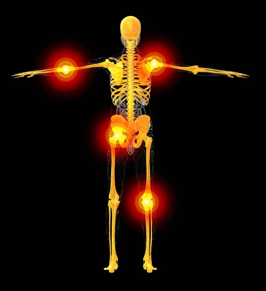 Medical Illustration Human Skeleton Back View — Stock Photo, Image