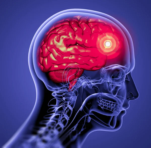 Medical Illustration Brain Side View — Stock Photo, Image