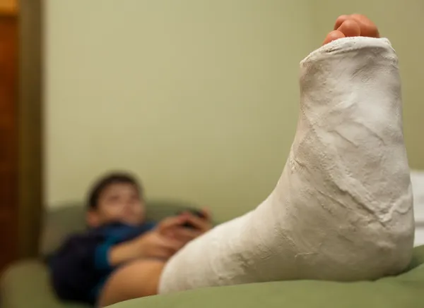 Leg in plaster — Stock Photo, Image