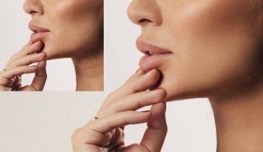 Avrupalı bir kadının yüzünün kırışıklıklarla, genişlemiş gözeneklerle ve siyah noktalarla yakın plan çekimlerinden önce ve sonra. Cilt bakımı Yüzünde sorun var. Dermatolojik kozmetik prosedürleri. Fotoğraf Gençleştirme