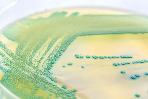 Bacteria in a petri dish — Stock Photo, Image