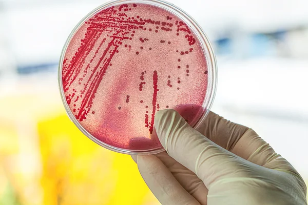 Петри блюдо с бактериями — стоковое фото