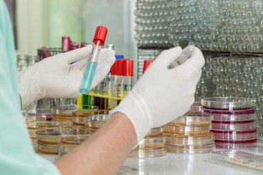 Laboratuar testlerinde