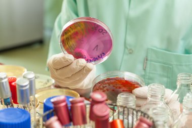 test tüpleri arasında Patri yemek