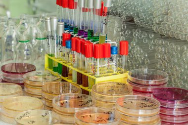 Agar plakaları ve test tüpleri