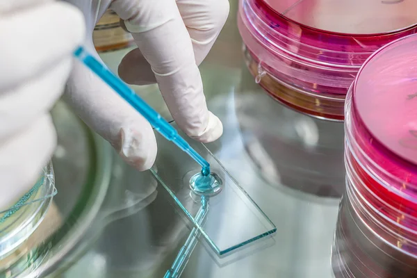 Pipette and the specimen — Stock Photo, Image