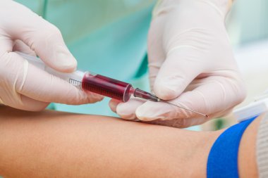 Syringe with blood sample clipart