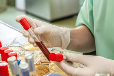 Laboratuvarda test tüpleri