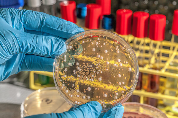 Грибы на агарной пластине
