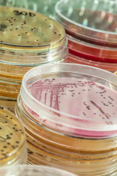 Bakterier testning — Stockfoto