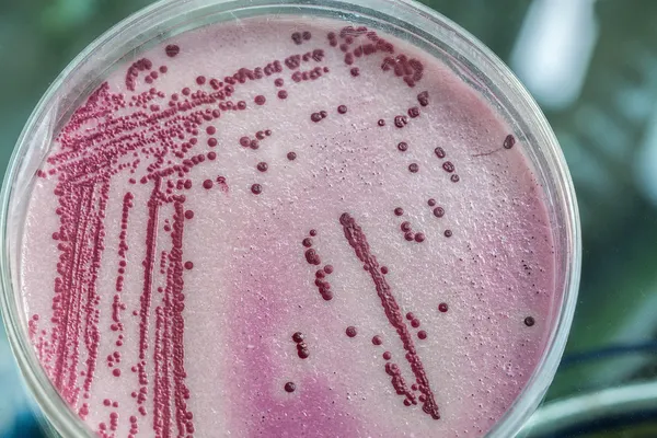 深粉色和红色的 microbacterias — 图库照片