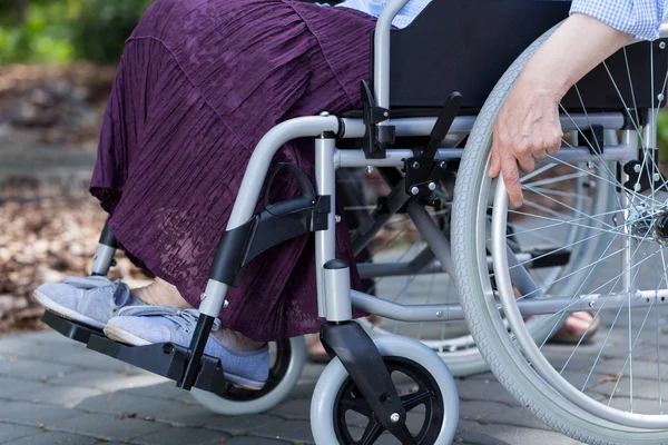 Benen av en handikappad kvinna — Stockfoto