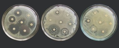 Antibiyogram çoklu ilaç direnci bakteri antimikrobiyal duyarlılık testleri