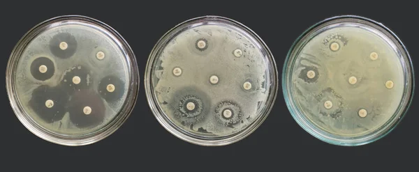 Antibiyogram çoklu ilaç direnci bakteri antimikrobiyal duyarlılık testleri