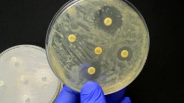Antimikrop direnci Disk Difüzyon Testi sonuçlarını kontrol ediyorum. Antibiyografi