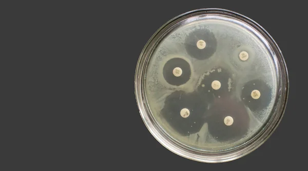Antibiyograma karşı çoklu ilaç direnci bakterileri antimikrobiyal duyarlılık testi