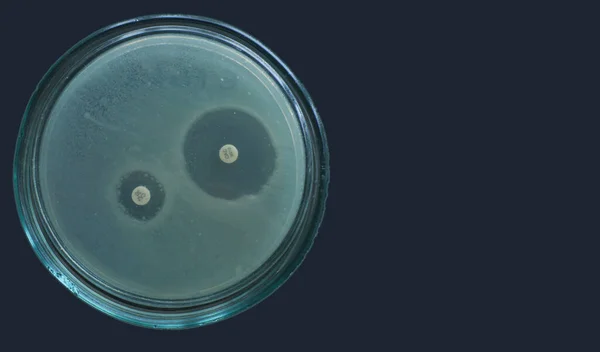 Escherichia coli difüzyon metodu testiyle beta laktamases tespiti