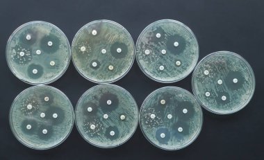 Antimikrobiyal duyarlılık testi Antibiyotik direnç bakterisi 