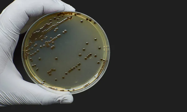 Black bacteria colonies on Selective media Agar Plates in petri dish — Stockfoto