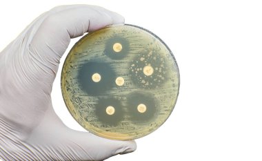 Antibiyogram antimikrobiyal duyarlılık direnci bakteri difüzyon testi