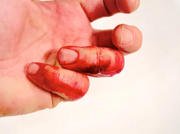 Kazalar olur ve sık sık yapmak