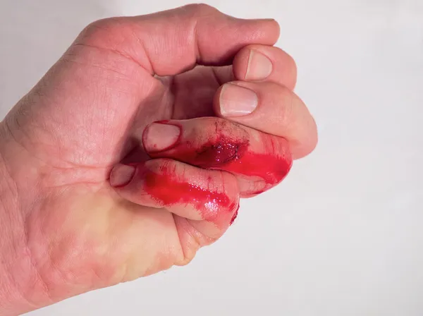 güldüğüm zaman sadece acıyor