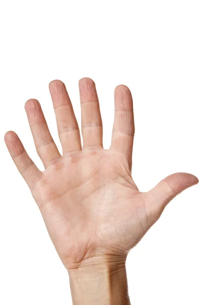 Hand med sex fingrar isolerad på vit — Stockfoto