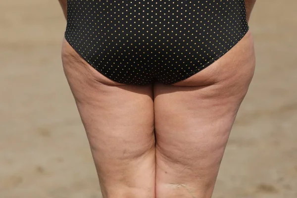 Tlusté Ženské Tělo Celulitidou Tučnými Boky Hýžděmi Izolované Bílém Pozadí — Stock fotografie