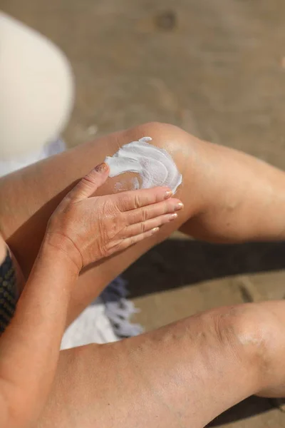 Överviktig kvinna applicera solskyddsmedel lotion på hennes ben med åderbråck, nära detalj. semester på havet strand — Stockfoto