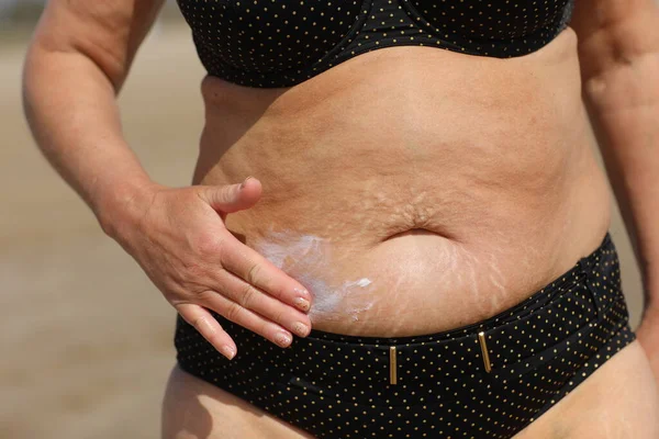 Şişman kadın göbeğine güneş kremi sürüyor. Gerilme izleri var. Detayları kapat. Yüksek kalite fotoğraf
