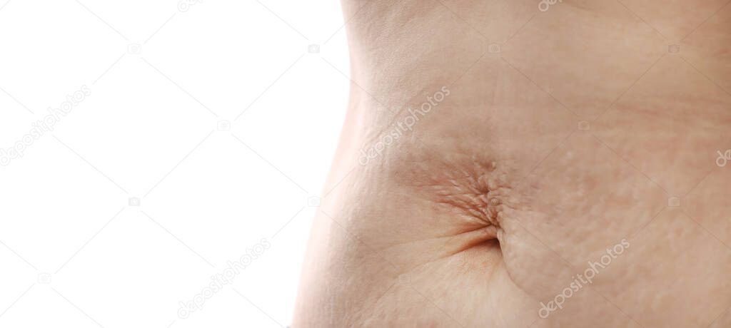 Close up of mother womans belly showing stretch mark loose lower abdomen skin she fat after pregnancy baby birth, studio isolated on white background, Healthy belly overweight excess body concept.