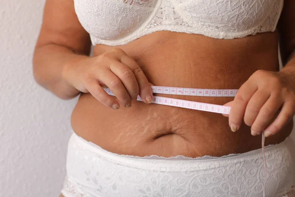 Cropped Photo Naked Overweight Woman Belly Underwear Trying Lose Weight — Stockfoto