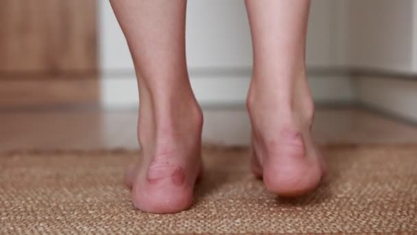 Woman Scratches Her Foot Calluses Blisters Painful Wounds Uncomfortable Shoes — Stock Video