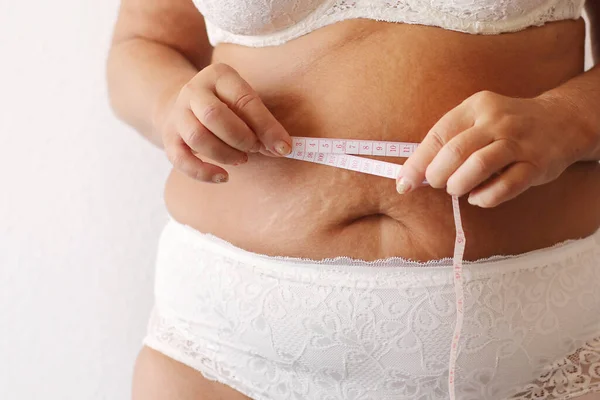 Cropped Photo Naked Overweight Woman Belly Underwear Trying Lose Weight — Stockfoto