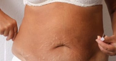 Cropped photo of naked overweight woman belly in underwear, trying to lose weight. Holding and measuring her waistline by roulette tape belly, abdomen. Fat large sagging folds on stomach. Excess skin.