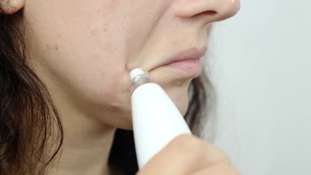 Woman Face Vacuum Face Pore Cleaner Cosmetic Skin Care High — Vídeos de Stock