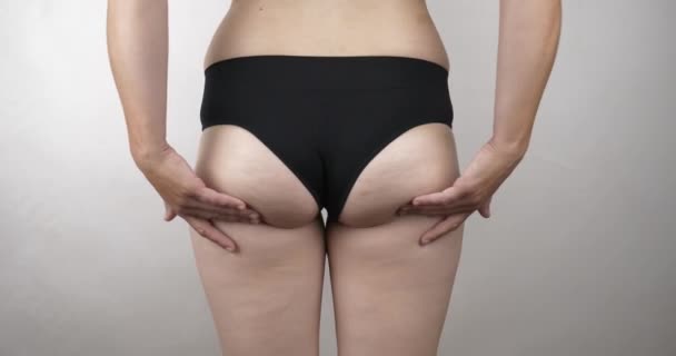 Obese Woman Shaking Buttocks Panties Obesity Overweight High Quality Footage — Video