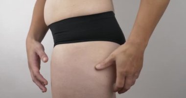 cellulite on female thigh, obesity on the legs on the buttocks High quality 4k footage