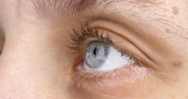 Weibliches Auge Mit Keratokonus Hornhautverdünnung Diagnostiziert Hochwertiges Filmmaterial — Stockvideo