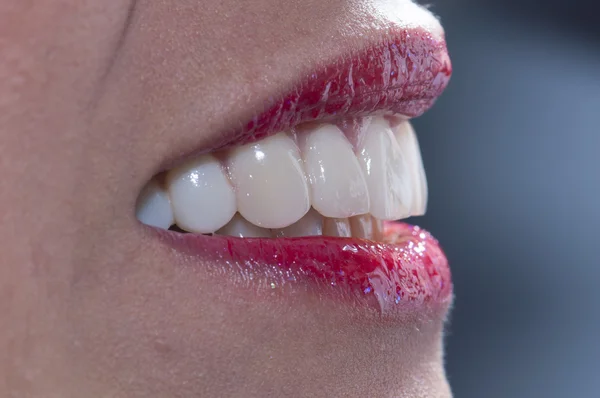 Woman smiling with great teeth — Stock Photo, Image