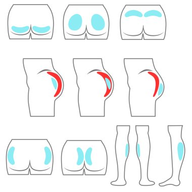 konum kalça ve baldır implantlar