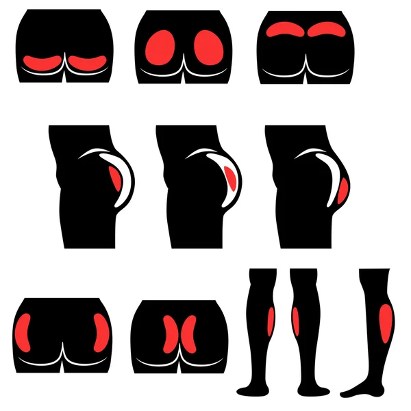 different types of buttocks shapes
