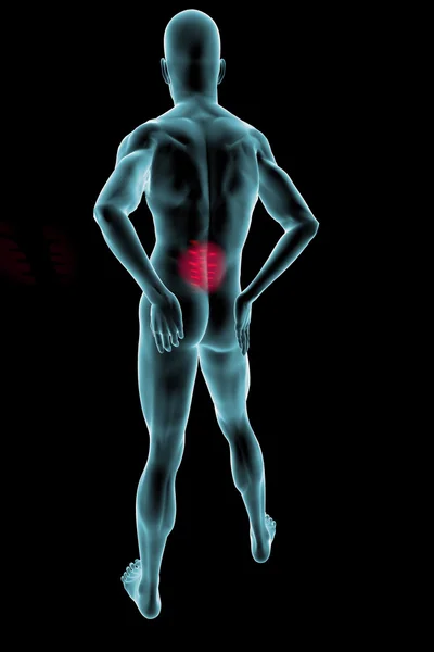 Man seen from behind with back pain — Stock Photo, Image