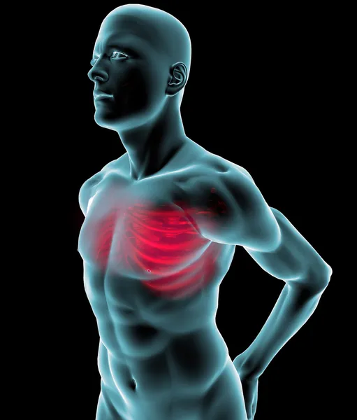 Radiografia umana con dolore nella gabbia toracica — Foto Stock