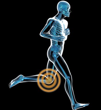 Side view of a running man seen by x-ray with pain in the leg clipart